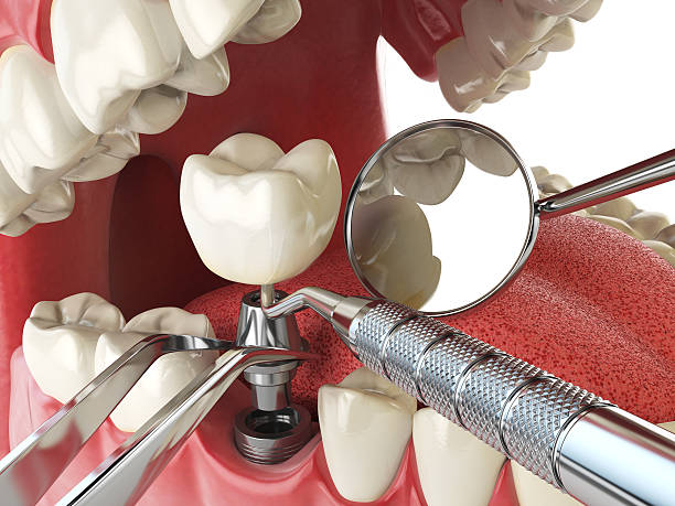 Best Urgent Dental Care in Manche Village, CA